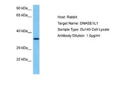 Deoxyribonuclease I like 1 Rabbit anti-Human, Polyclonal, Novus Biologicals